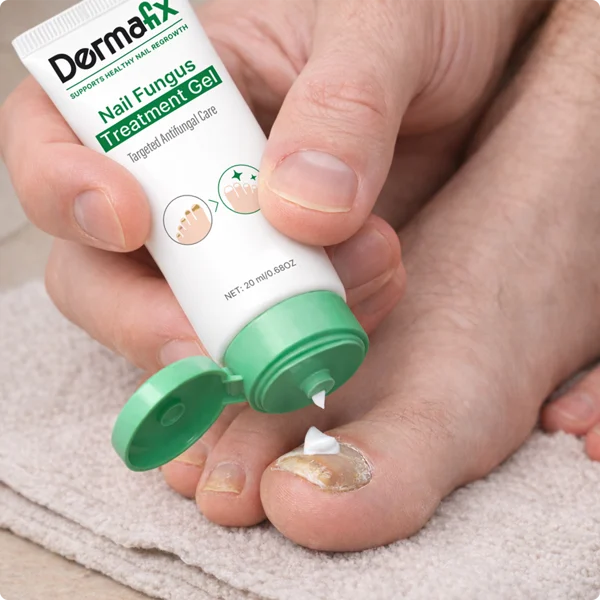 Applying DermaFix nail fungus gel